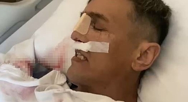 İstanbul'da burun estetiği ameliyatının ardından hayatını kaybetti