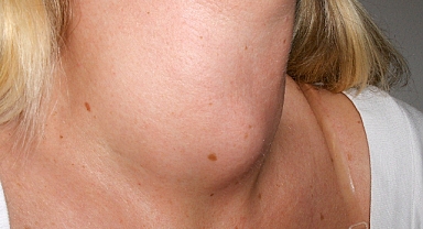 Genel cerrahi uzmanı Op. Dr. Murat Uzuner: 