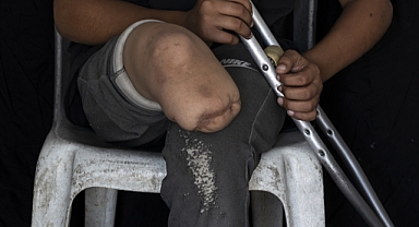 Gazze'de Binlerce Çocuk İsrail Saldırılarında Uzuvlarını Kaybetti