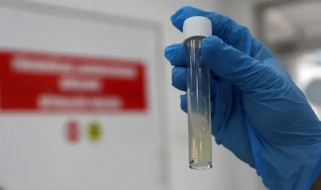 DSÖ: Tüberküloz, 2024'te 1,23 milyon kişinin ölümüne yol açtı