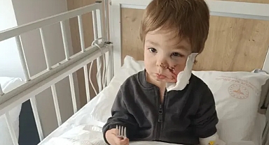 Etimesgut'ta Pitbull Saldırısı