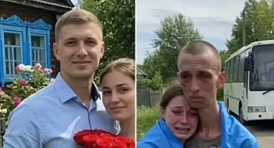 Rusya Ukrayna Savaşının Acı Yüzü